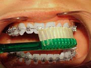 Brushing step 3