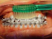 Brushing step 4