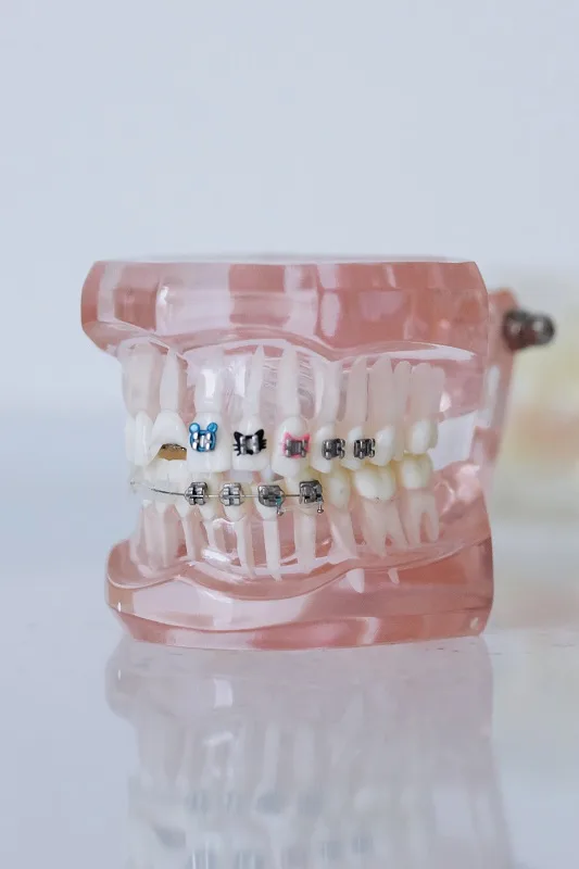Moving Your Teeth With Braces